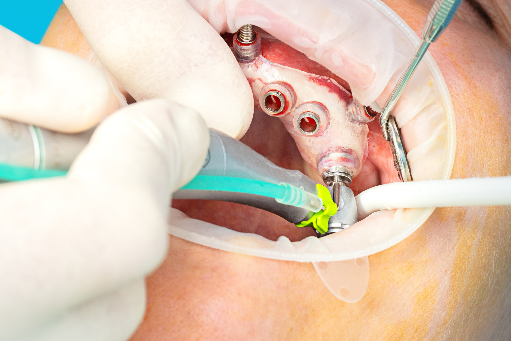 Cirurgia Guiada